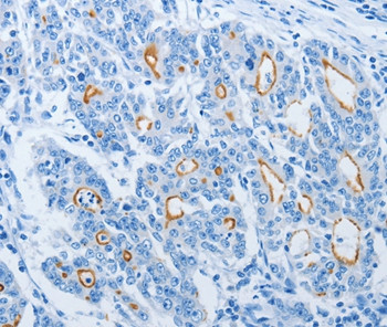 NEK10 Antibody in Immunohistochemistry (Paraffin) (IHC (P))