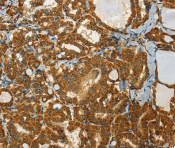 C15orf2 Antibody in Immunohistochemistry (Paraffin) (IHC (P))