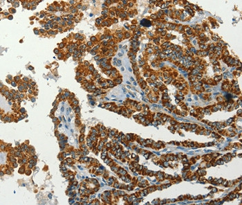 SERPINA9 Antibody in Immunohistochemistry (Paraffin) (IHC (P))