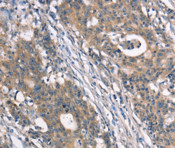 NDNL2 Antibody in Immunohistochemistry (Paraffin) (IHC (P))