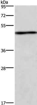 UHMK1 Antibody in Western Blot (WB)