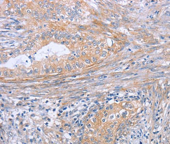 FAM44B Antibody in Immunohistochemistry (Paraffin) (IHC (P))