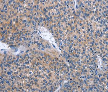 IBSP Antibody in Immunohistochemistry (Paraffin) (IHC (P))