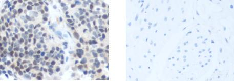 CAMTA1 Antibody in Immunohistochemistry (Paraffin) (IHC (P))