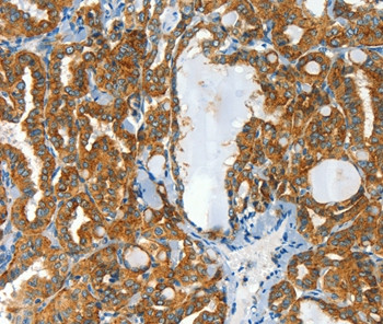 CLPTM1L Antibody in Immunohistochemistry (Paraffin) (IHC (P))