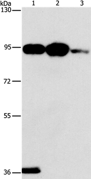 PLA2G4B Antibody in Western Blot (WB)