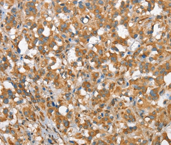CSMD1 Antibody in Immunohistochemistry (Paraffin) (IHC (P))