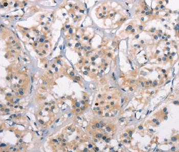 NY-ESO-1 Antibody in Immunohistochemistry (Paraffin) (IHC (P))
