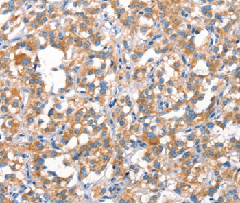 MT-CYB Antibody in Immunohistochemistry (Paraffin) (IHC (P))