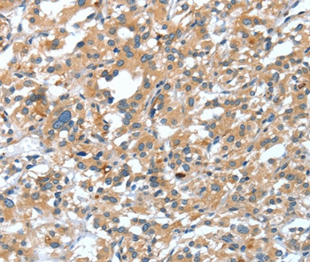 DSC1 Antibody in Immunohistochemistry (Paraffin) (IHC (P))