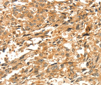 DIRAS1 Antibody in Immunohistochemistry (Paraffin) (IHC (P))