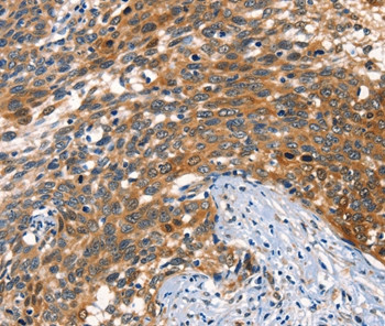 AGO1 Antibody in Immunohistochemistry (Paraffin) (IHC (P))