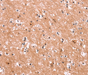 ENPP4 Antibody in Immunohistochemistry (Paraffin) (IHC (P))