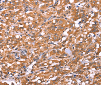 FAM13B Antibody in Immunohistochemistry (Paraffin) (IHC (P))