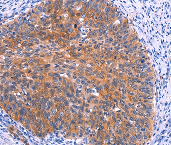 PTPN13 Antibody in Immunohistochemistry (Paraffin) (IHC (P))