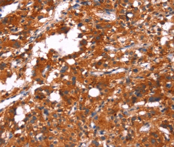 FEM1A Antibody in Immunohistochemistry (Paraffin) (IHC (P))