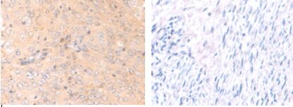 HCAR2 Antibody in Immunohistochemistry (Paraffin) (IHC (P))