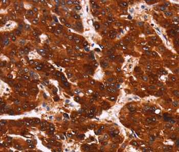 TEM5 Antibody in Immunohistochemistry (Paraffin) (IHC (P))