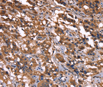 GREB1 Antibody in Immunohistochemistry (Paraffin) (IHC (P))