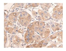 HAS1 Antibody in Immunohistochemistry (Paraffin) (IHC (P))