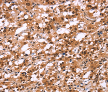 HIPK1 Antibody in Immunohistochemistry (Paraffin) (IHC (P))