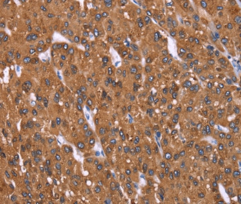 HRASLS2 Antibody in Immunohistochemistry (Paraffin) (IHC (P))