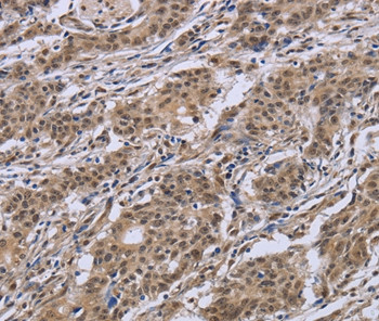 Importin 8 Antibody in Immunohistochemistry (Paraffin) (IHC (P))