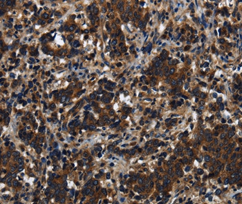 KLHL8 Antibody in Immunohistochemistry (Paraffin) (IHC (P))