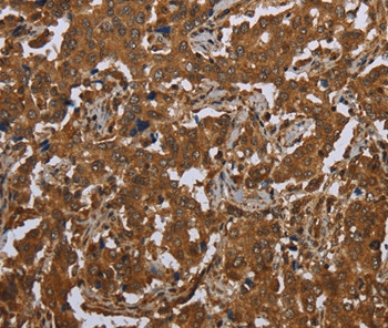 SCGB1D2 Antibody in Immunohistochemistry (Paraffin) (IHC (P))