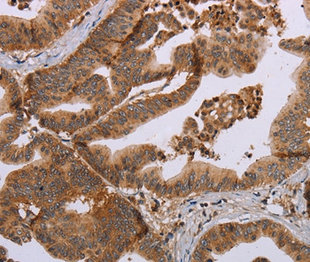 MFAP5 Antibody in Immunohistochemistry (Paraffin) (IHC (P))