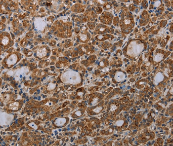MDFIC Antibody in Immunohistochemistry (Paraffin) (IHC (P))
