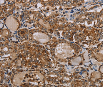 MT-ND6 Antibody in Immunohistochemistry (Paraffin) (IHC (P))