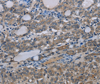 MT-ND3 Antibody in Immunohistochemistry (Paraffin) (IHC (P))