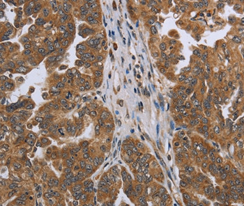 NDUFAF4 Antibody in Immunohistochemistry (Paraffin) (IHC (P))