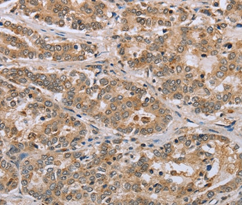 CLEC16A Antibody in Immunohistochemistry (Paraffin) (IHC (P))