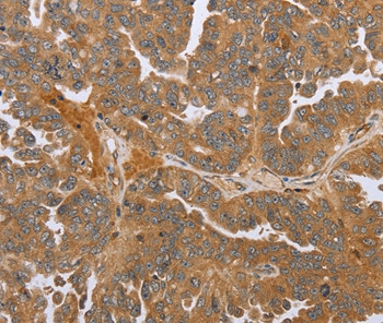 NMT1 Antibody in Immunohistochemistry (Paraffin) (IHC (P))