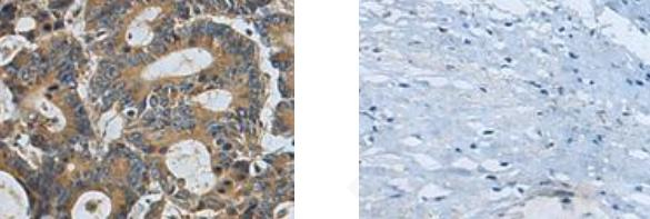 SLC22A12 Antibody in Immunohistochemistry (Paraffin) (IHC (P))
