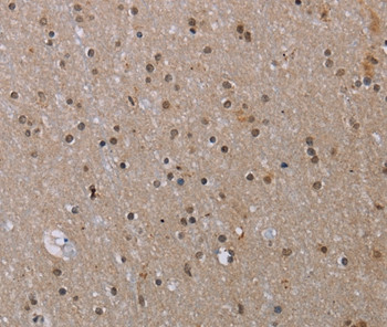 MED12 Antibody in Immunohistochemistry (Paraffin) (IHC (P))