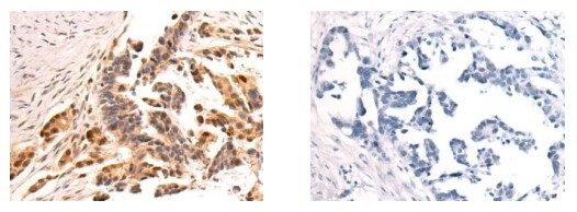 PARP8 Antibody in Immunohistochemistry (Paraffin) (IHC (P))