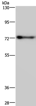 PATZ1 Antibody in Western Blot (WB)