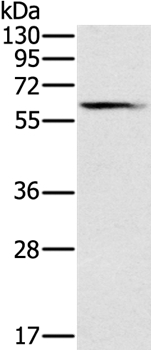 Prostein Antibody in Western Blot (WB)