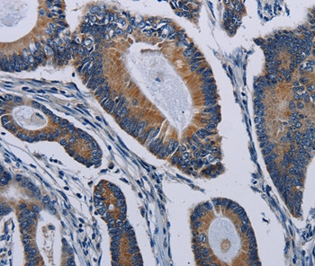 PCDHAC2 Antibody in Immunohistochemistry (Paraffin) (IHC (P))