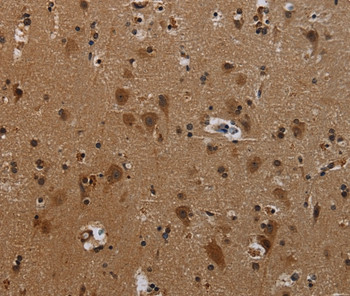 PCDHB11 Antibody in Immunohistochemistry (Paraffin) (IHC (P))