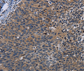 PCDHB15 Antibody in Immunohistochemistry (Paraffin) (IHC (P))
