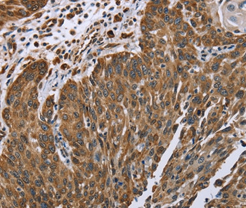 PLXNB1 Antibody in Immunohistochemistry (Paraffin) (IHC (P))