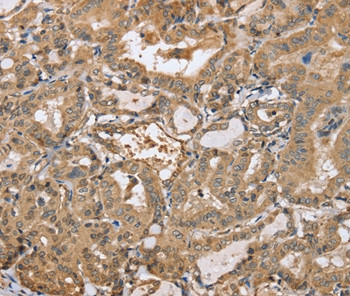 PPP2R3A Antibody in Immunohistochemistry (Paraffin) (IHC (P))