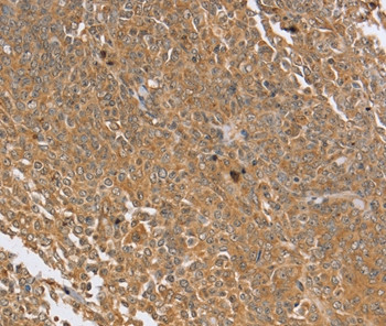 PTPN20A Antibody in Immunohistochemistry (Paraffin) (IHC (P))