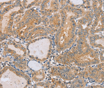 PTPN4 Antibody in Immunohistochemistry (Paraffin) (IHC (P))