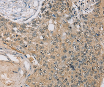 RASA2 Antibody in Immunohistochemistry (Paraffin) (IHC (P))