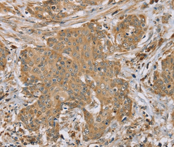 RNF148 Antibody in Immunohistochemistry (Paraffin) (IHC (P))